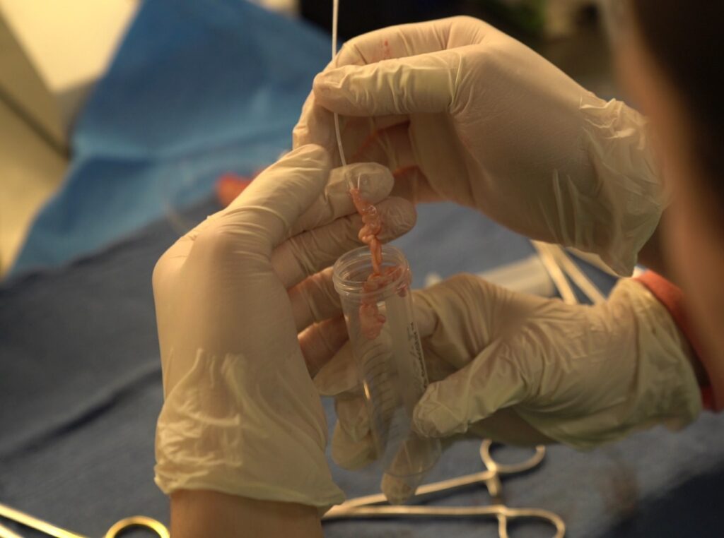 Epididymal freezing